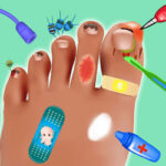 Toenail Healing Game